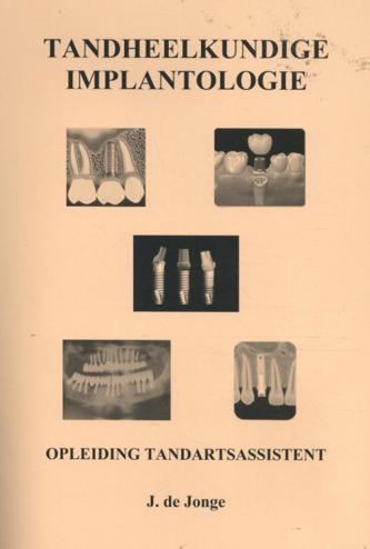 9789081698337 - Tandheelkundige implantologie