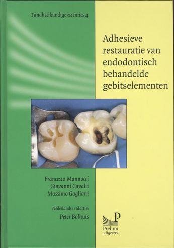 9789085620587 - Adhesieve restauratie van endodontisch behandelde gebitselementen