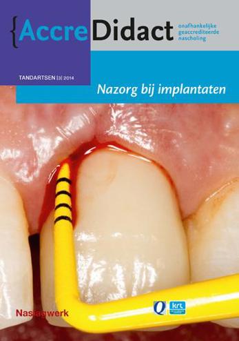 9789089761620 - Nazorg bij implantaten