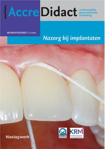 9789089763563 - Nazorg bij implantaten
