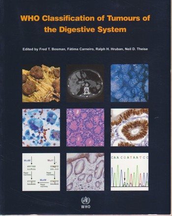 Studieshop | Classification of Tumours of Soft Tissue and Bone ...
