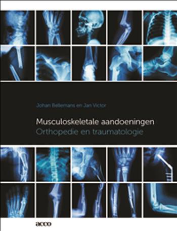 9789463443890 - Musculoskeletale aandoeningen: orthopedie en traumatologie